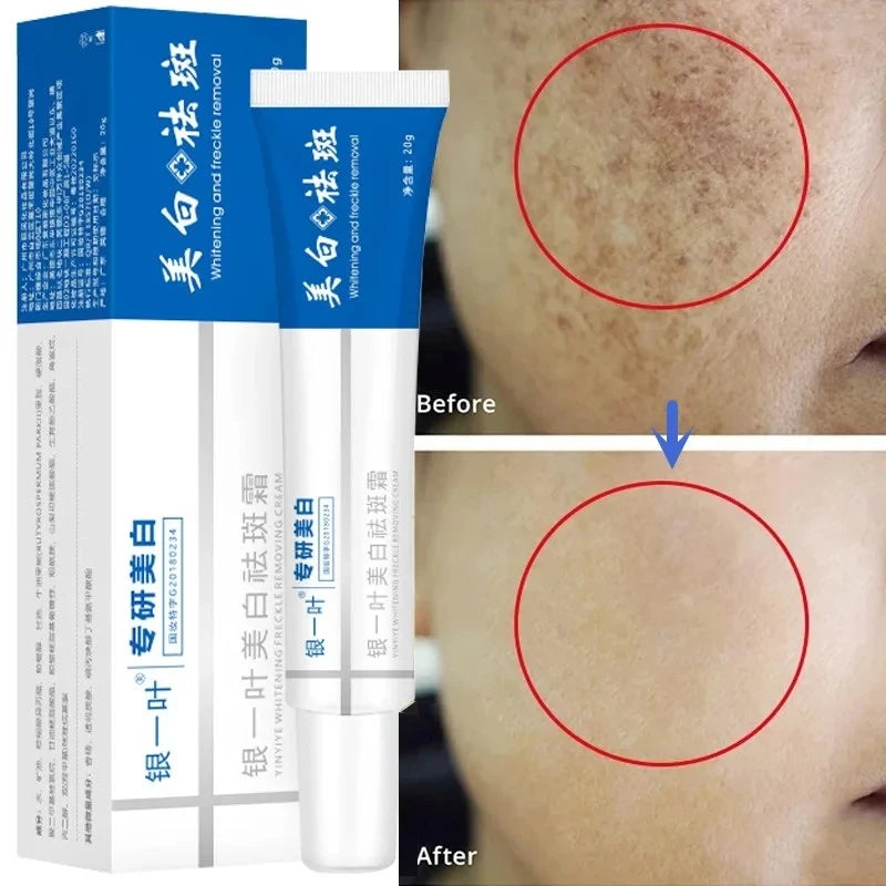 CREMA BLANQUEADORA PARA PECAS Y MELASMA.